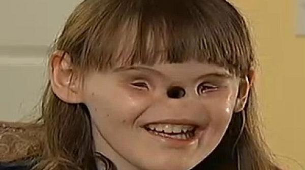 adolescenta fara ochi si nas se pregateste sa inceapa o noua viata