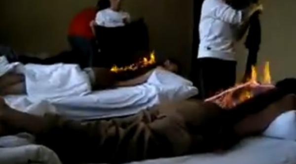 tratament cu foc pentru dureri de spate video