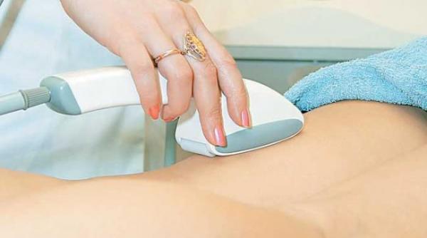 epilarea si riscul de infectii