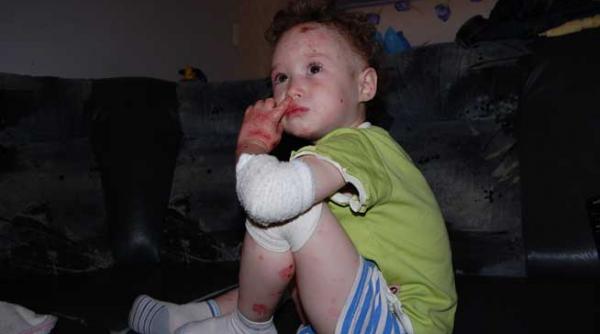 impreuna salvam vieti alesiei maria truica i s a redat vederea cu ajutorul dvs in campania vreau sa ajut