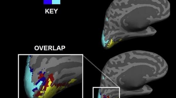 medicii uluiti ce au descoperit neurologii americani la un barbat i a fascinat de a dreptul