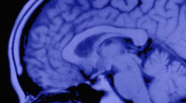 un virus a transformat o in cateva ore intr un zombi