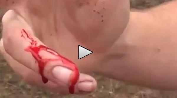 cata minte iti trebuie la un pas sa ramana fara degete dupa ce a chinuit o broasca video