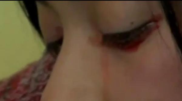 medicii nu au putere in fata acestei boli o tanara plange cu lacrimi de sange video