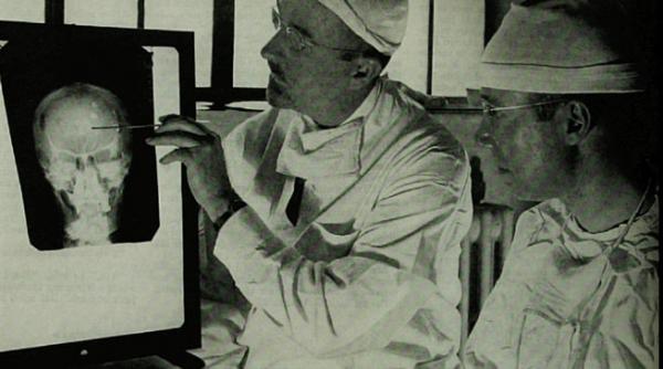 practici bizare de a lungul istoriei cum erau tratati pacientii cand operatiile se faceau fara anestezie