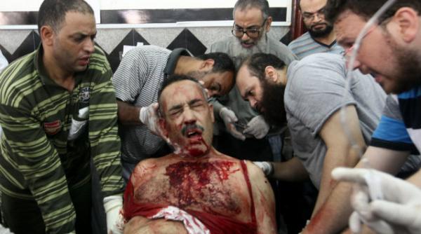 violentele iau amploare in egipt 51 de morti si sute de raniti in confruntarile dintre fratii musulmani si armata