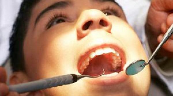 dinti cariati celule susa