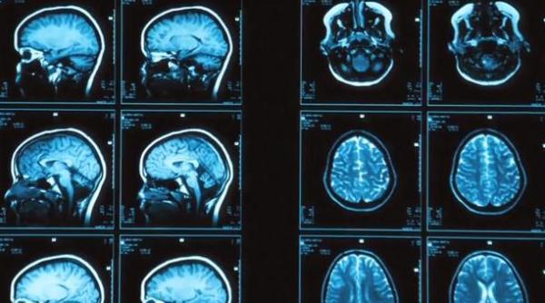 descoperire socanta ce a aflat un neurolog american dupa ce fara sa vrea si a studiat propriile rmn uri video