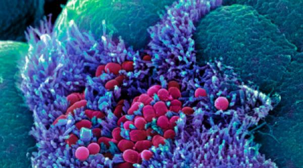 flora intestinala aliat contra cancerului