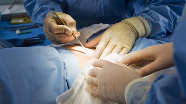 protestul unui chirurg facem zilnic asta desi stim ca este malpraxis