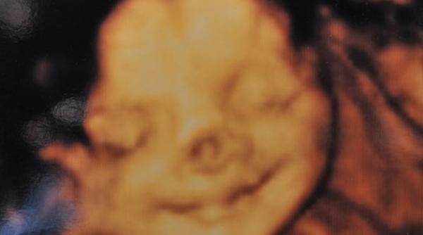 zara green a trait ocul vie ii cand i a vazut pentru prima data fiica nou nascuta cum arata micu a la na tere