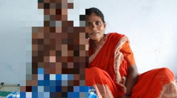 oamenii incremenesc de spaima cand il vad cum arata un barbat din india supranumit omul balon video