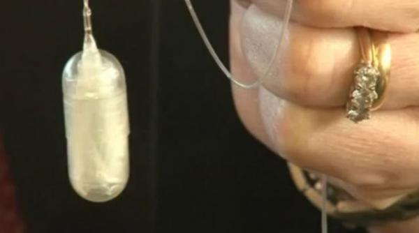 balon stomac obezitate