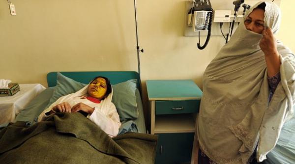 sentinta unui tribunal iranian pentru un barbat care a mutilat cu acid o femeie sa i se scoata ochii sa i se taie nasul si urechile