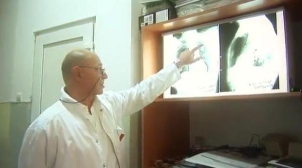 aparatul laser care prelungeste viata in metastaza pulmonara