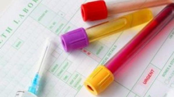 descoperire uluitoare un simplu test de sange poate depista cancerul