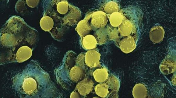 oms rezistenta bacteriilor la antibiotice o amenintare globala majora