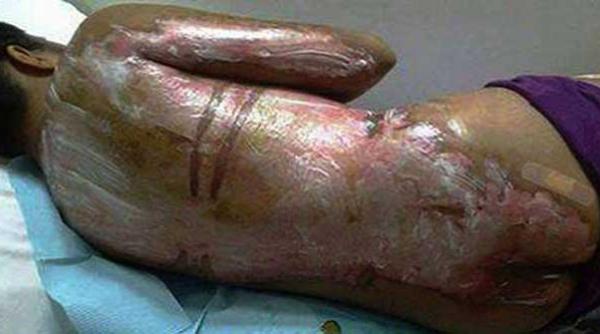 o menajera a fost oparita cu apa clocotita pentru ca nu a servit cafeaua la timp