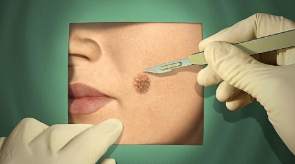 cat de periculoase sunt alunitele