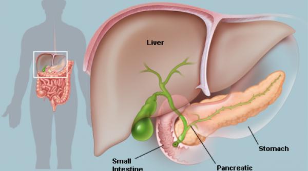 pancreatita boala exceselor alimentare cum o recuno ti cum o previi