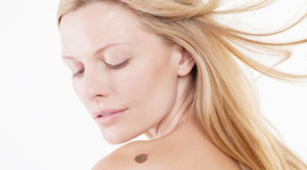 seminifica ia aluni elor in func ie de locul unde se gasesc pe corp