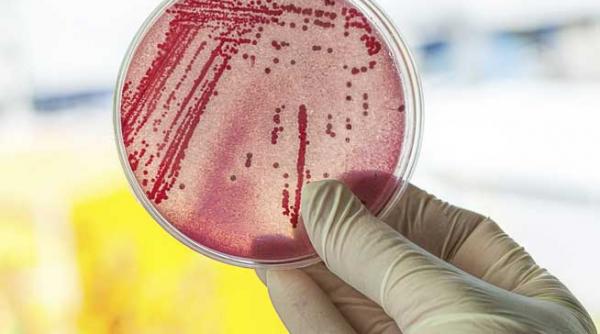 ebola bate cifrele oms