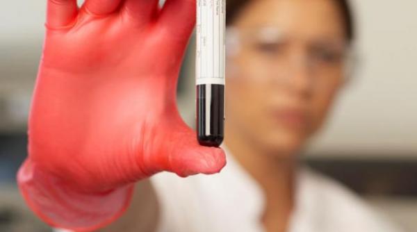 13 tipuri de cancer ar putea fi depistate timpuriu datorita unui simplu test sanguin