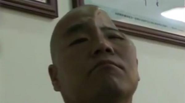 craniu refacut imprimanta 3d