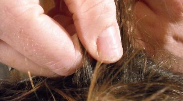 romania 2014 cu paduchii la scoala