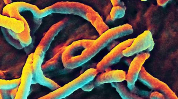 ebola cine nu moare se vindeca