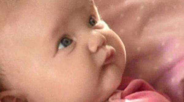medicii nu gasesc nicio explicatie ce pateste o fetita de doua luni daca e atinsa nu am mai vazut asa ceva video