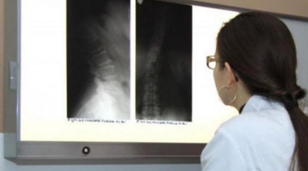 marimea conteaza prima operatie de reducere a penisului foto