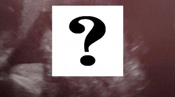 ecografie evolutie sarcina medic fatul