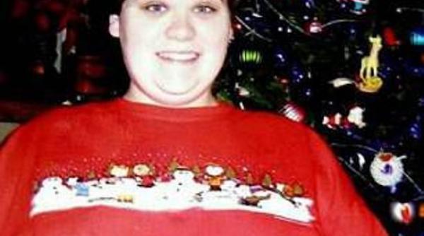 un barbat a primit despagubire 2 5 milioane de dolari pentru ca i au crescut sani enormi din cauza unui medicament