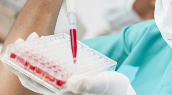 hiv sida anual circa 1 000 de cazuri noi