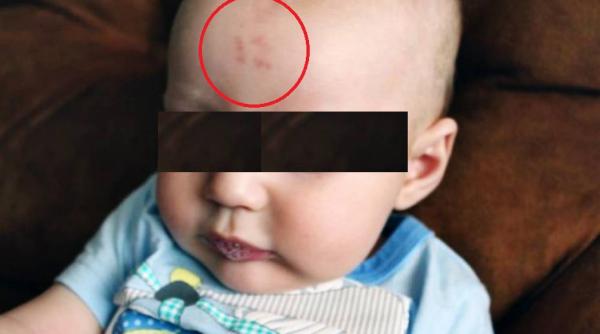 medicii usor confuzi dupa ce un copil s a nascut insemnat cu cifra 12 pe frunte ce ar putea insemna