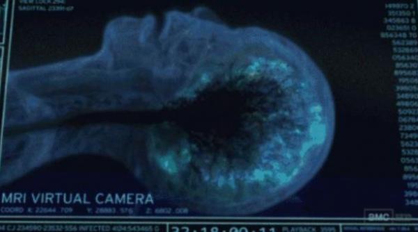 o noua descoperire contrazice orice practica medicala de urgenta ce se intampla in creier in momentele dinaintea mortii