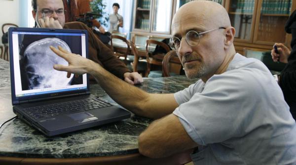 un neurochirurg italian se pregateste sa faca primul transplant de cap