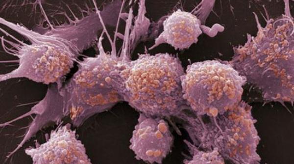 posibil tratament contra cancerului de piele