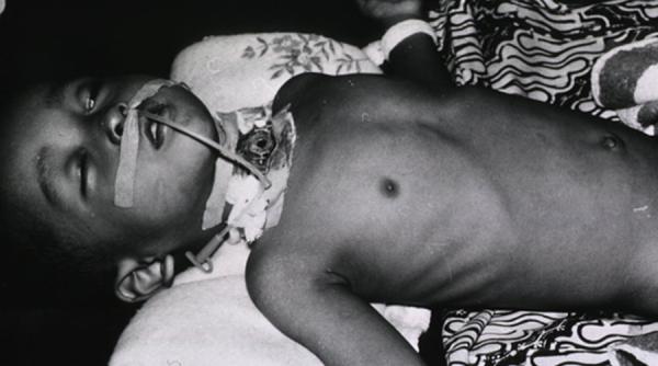 un copil risca sa moara pentru ca parintii au decis sa nu il vaccineze