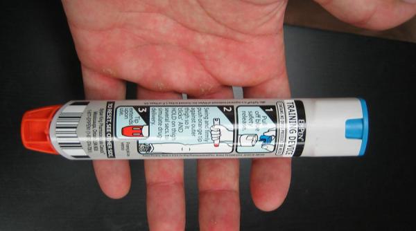 ce este si ce trebuie sa stim despre socul anafilactic