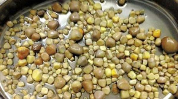 de ce un barbat avea cateva sute de pietre in rinichi