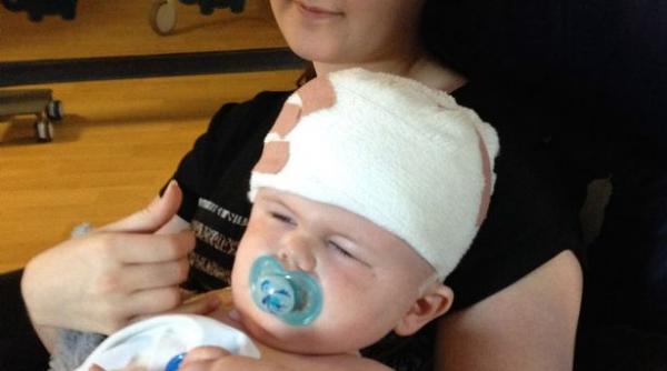 la numai doi ani medicii i au spart capul ca sa il salveze