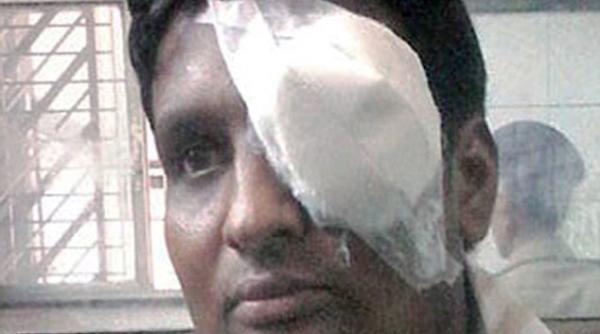 un barbat s a ranit grav dupa ce i a explodat telefonul