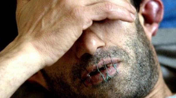 un detinut de la penitenciarul giurgiu si a cusut gura