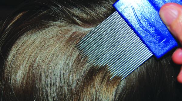 ce faci daca cel mic a luat paduchi