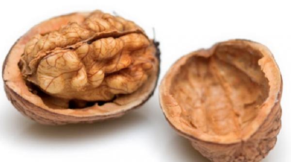 nucile doctorul inimii si al creierului