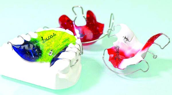 de la ce varsta putem purta aparat dentar