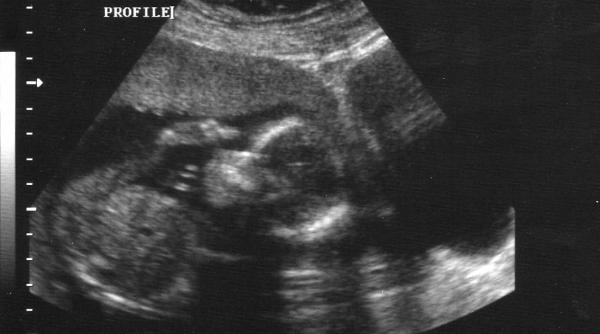 vesti alarmante de ce umanitatea risca sa nu se mai poata reproduce