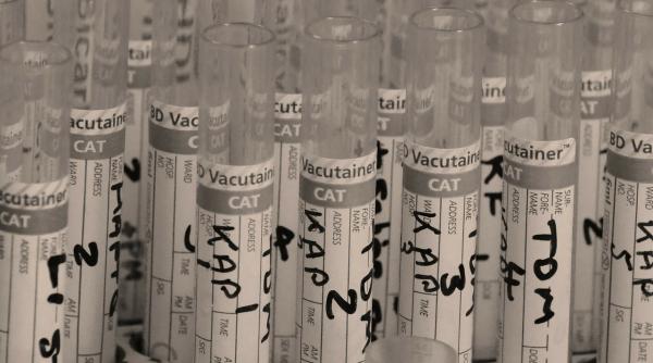 romanii se pot testa gratuit pentru hiv si virusurile hepatice b si c